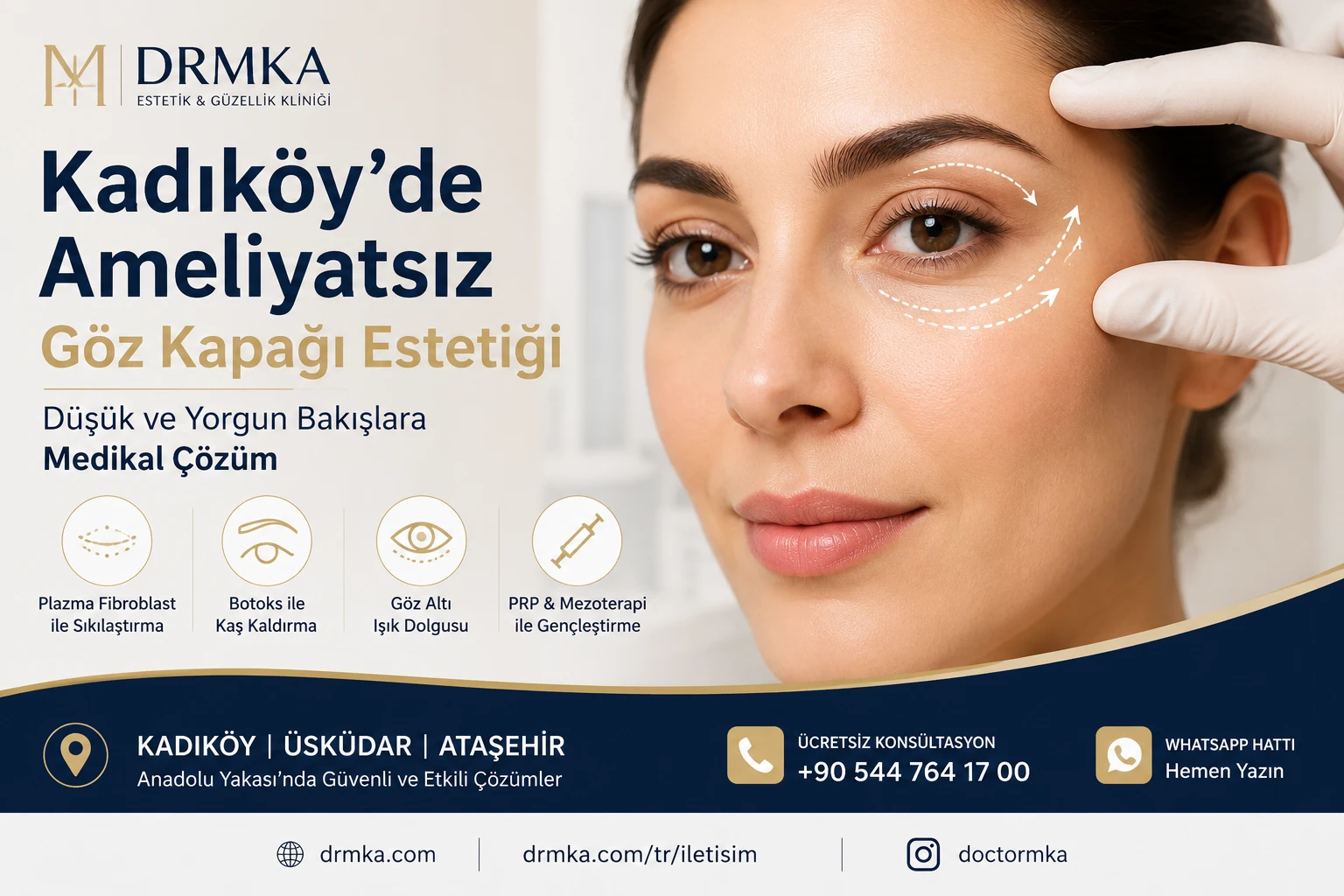Kadıköy Ameliyatsız Göz Kapağı Estetiği